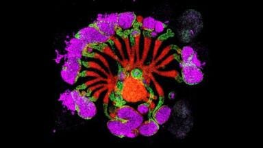 Lab-grown kidney organoids set to recast research landscape into kidney disease