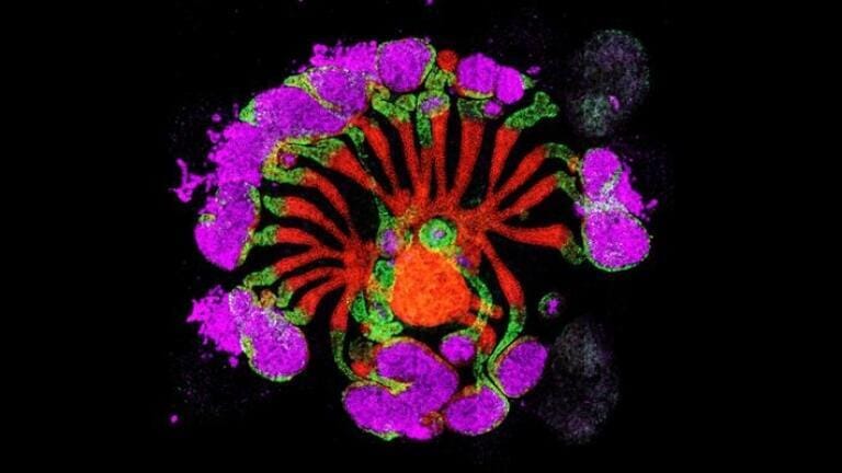 Lab-grown kidney organoids set to recast research landscape into kidney disease