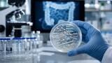 Live gut bacteria platform set to widen access to microbiome therapy for C. diff