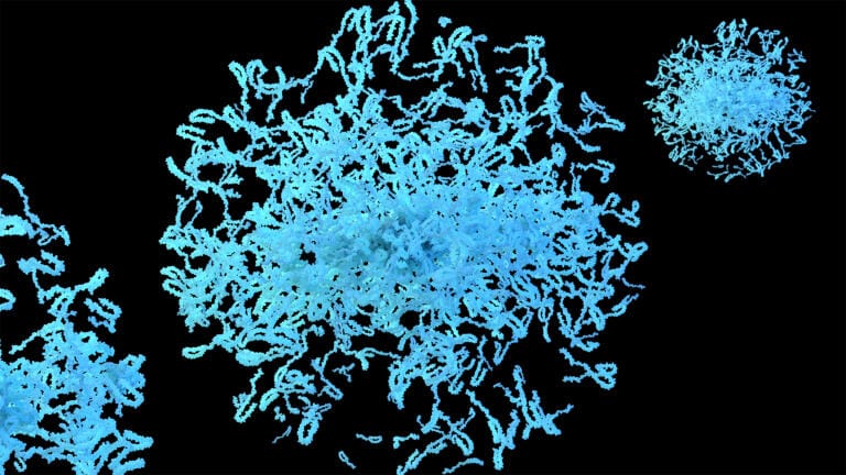 Researchers visualise Parkinson’s-linked protein aggregates in the living brain
