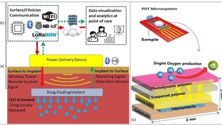 Illustration of an implantable photodynamic therapy system. Credit: University of Glasgow