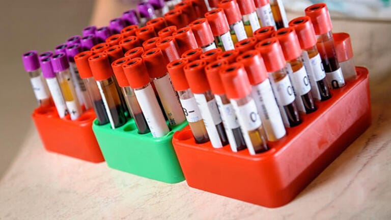 High-quality blood products with next-day delivery