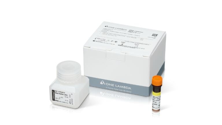 Expanded HLA-DQ testing supports improved transplant decisions
