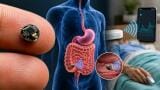 MIT develops tiny ingestible sensor that can measure core body temperature