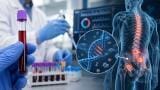 DNA blood test could identify prostate cancer patients that are most likely to benefit from radium-223 radio therapy