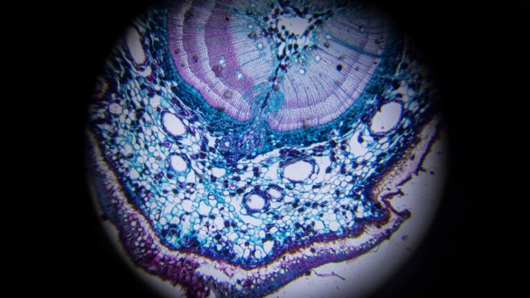 High-resolution digital images support pathology diagnosis. Credit: Exponential-e