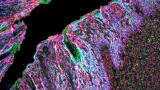 Simplifying high-sensitivity immunofluorescence