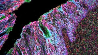 Simplifying high-sensitivity immunofluorescence