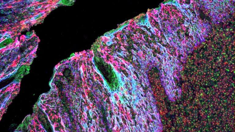 Simplifying high-sensitivity immunofluorescence