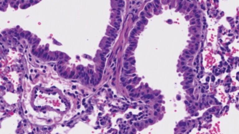 Arginine deficiency found to weaken the immunity against cancer and viruses