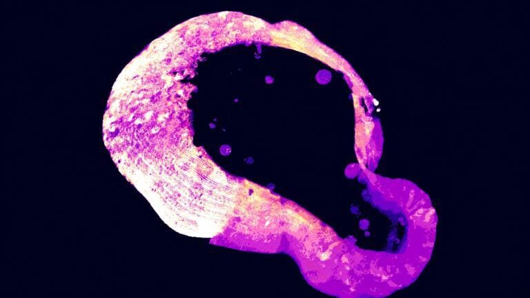 Biologists solve decades-old mystery of polyamines’ cellular role in iron toxicity