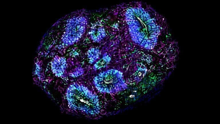 Human brain organoids mature for more than five years in laboratory culture