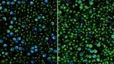 Optical imaging can reveal the metabolic activity of individual immune cells