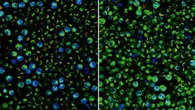 Optical imaging can reveal the metabolic activity of individual immune cells