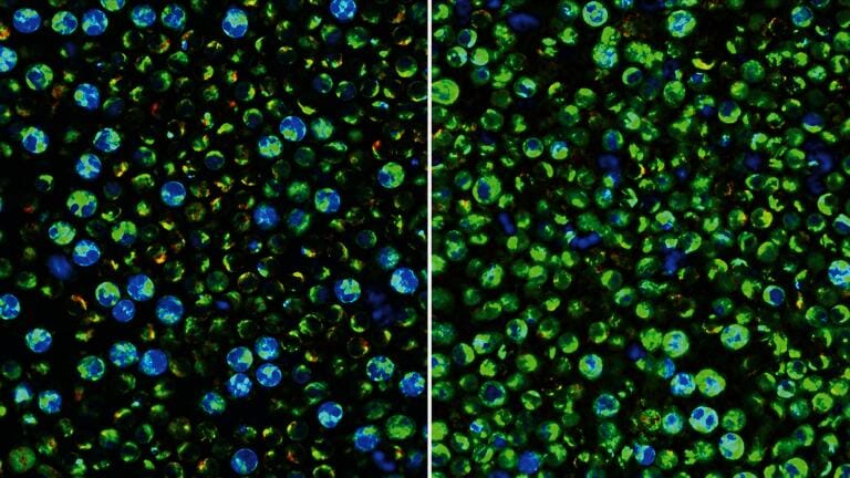 Optical imaging can reveal the metabolic activity of individual immune cells