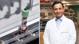 Blood test detects early-stage pancreatic cancer with 87 per cent sensitivity