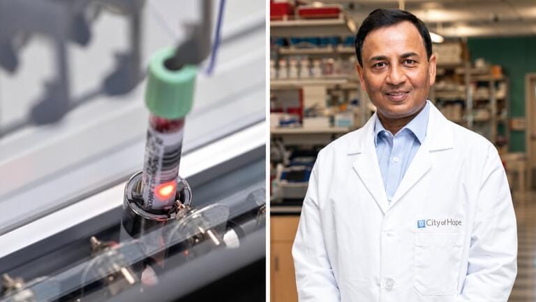 Blood test detects early-stage pancreatic cancer with 87 per cent sensitivity