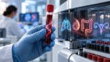 Seventeen cancers found in prospective study of novel multicancer blood test