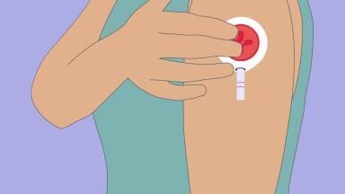 Transforming the future of blood collection