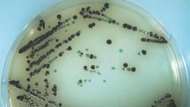 Easy as ABC the identification of Salmonella species.