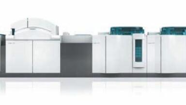 New Assay Allows Earlier Diagnosis of Impaired Renal Function