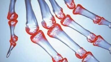 Fully Automated Diagnosis and Prognostic Testing for RA