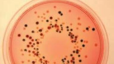 Integral Supplement to E. coli O157 Isolation