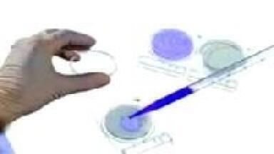 New, Easy and Cost Effective Innovation for Micro-organism Identification and Counting.
