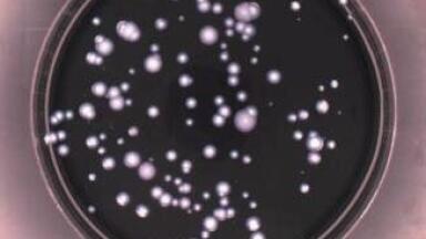Speeding up Detection of Legionella in Contaminated Water Supplies