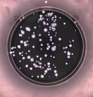 Speeding up Detection of Legionella in Contaminated Water Supplies