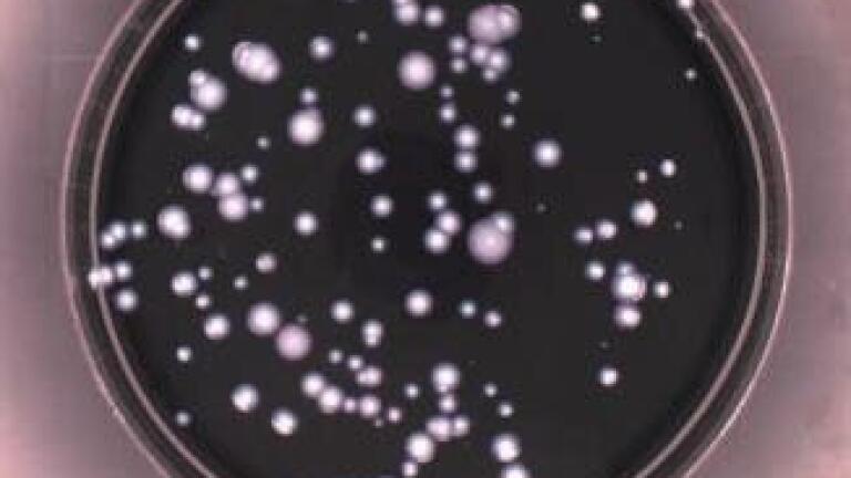 Speeding up Detection of Legionella in Contaminated Water Supplies