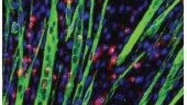 IN Cell Image Competition