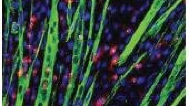 IN Cell Image Competition
