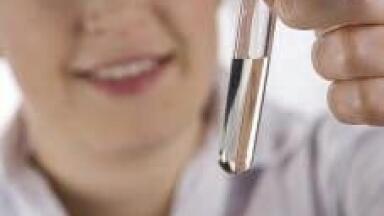 New Tubes Make Automated Urinalysis Easy