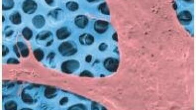Nano Instruments Provide Options to Meet Healthcare Challenges
