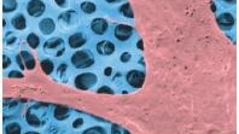Nano Instruments Provide Options to Meet Healthcare Challenges