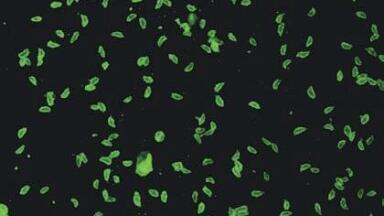 New Toxoplasma Gondi Antibodies