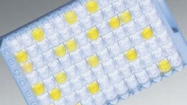 Rapid Diagnosis of the Causes of Gastroenteritis