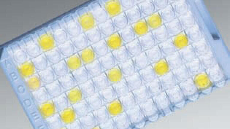 Rapid Diagnosis of the Causes of Gastroenteritis