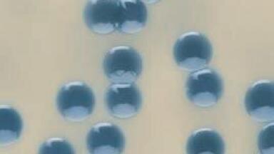 Identifying Staphylococci in Foods within 24 Hours
