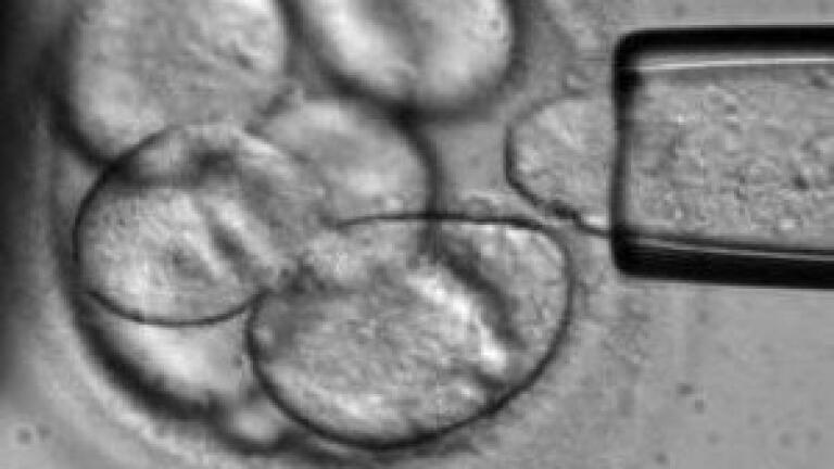 Euro-BioImaging Project: !st Open Call for Nodes
