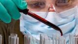 DPFS Scheme Supports Research into Prostate Cancer