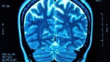 Pilot trial tests Decellularised Skin Grafts