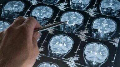 Advanced Digital Pathology Solution for Tissue Microarray Analysis and Research