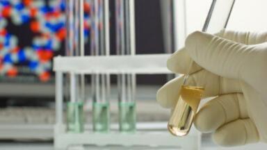 Novel Design Reagent Reservoirs