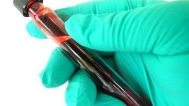 Global Drug Development Firm to create Edinburgh HQ